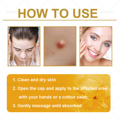 Mayo Clinic Official:🥇🥇 APKAPK™ Bee Venom Skin Treatment Cream, Anti-aging, Hydrating, Skin Repair, Even Tone, Acne and Dark Spot Treatment, Wart and Mole Removal, Psoriasis Relief