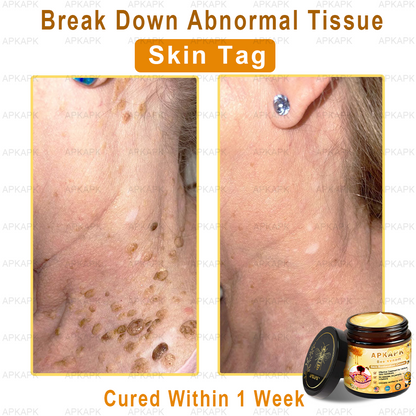 𝐌𝐚𝐲𝐨 𝐂𝐥𝐢𝐧𝐢𝐜 𝐎𝐟𝐟𝐢𝐜𝐢𝐚𝐥:🥇 𝐀𝐏𝐊𝐀𝐏𝐊™ 𝐁𝐞𝐞 𝐕𝐞𝐧𝐨𝐦 𝐒𝐤𝐢𝐧 𝐑𝐞𝐬𝐭𝐨𝐫𝐚𝐭𝐢𝐨𝐧 𝐂𝐫𝐞𝐚𝐦, 𝐀𝐧𝐭𝐢-𝐚𝐠𝐢𝐧𝐠, 𝐇𝐲𝐝𝐫𝐚𝐭𝐢𝐧𝐠, 𝐒𝐤𝐢𝐧 𝐑𝐞𝐩𝐚𝐢𝐫, 𝐄𝐯𝐞𝐧 𝐓𝐨𝐧𝐞, 𝐀𝐜𝐧𝐞 𝐚𝐧𝐝 𝐃𝐚𝐫𝐤 𝐒𝐩𝐨𝐭 𝐓𝐫𝐞𝐚𝐭𝐦𝐞𝐧𝐭, 𝐖𝐚𝐫𝐭 𝐚𝐧𝐝 𝐌𝐨𝐥𝐞 𝐑𝐞𝐦𝐨𝐯𝐚𝐥, 𝐏𝐬𝐨𝐫𝐢𝐚𝐬𝐢𝐬 𝐑𝐞𝐥𝐢𝐞𝐟