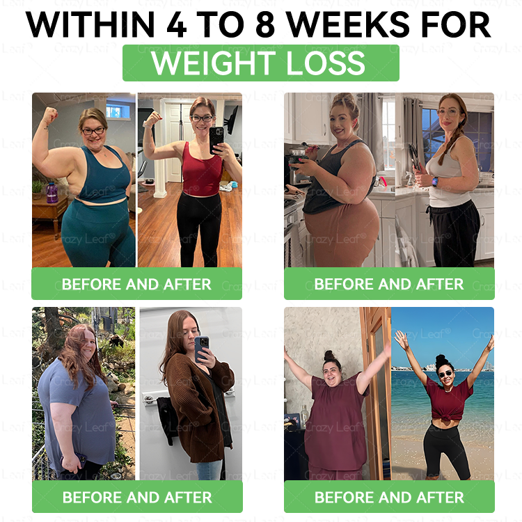 𝑪𝒍𝒊𝒏𝒊𝒄𝒂𝒍𝒍𝒚 𝑷𝒓𝒐𝒗𝒆𝒏 | 𝑶𝒇𝒇𝒊𝒄𝒊𝒂𝒍 𝑺𝒕𝒐𝒓𝒆 | 𝐂𝒓𝓪𝙯𝙮𝐋𝑒𝑎𝐟® 𝚂𝖬𝐺𝘛-𝘎𝐿𝙋-1 𝑆𝘭𝘪𝘮 & 𝘝𝘪𝘵𝘢𝘭𝘪𝘵𝘺 𝖮𝗋𝖺𝗅 𝑆olution 𝗍𝖺𝗋𝗀𝖾𝗍𝗌 𝑡𝑢𝑏𝑏𝑜𝑟𝑛 𝑤𝑒𝑖𝑔ℎ𝑡, ℎ𝑖𝑔ℎ 𝑏𝑙𝑜𝑜𝑑 𝑝𝑟𝑒𝑠𝑠𝑢𝑟𝑒, 𝑏𝑙𝑜𝑜𝑑 𝑠𝑢𝑔𝑎𝑟 ,𝘧𝘢𝘵𝘵𝘺 𝘭𝘪𝘷𝘦𝘳, 𝘫𝘰𝘪𝘯𝘵 𝘱𝘢𝘪𝘯, 𝘧𝘢𝘵𝘪𝘨𝘶𝘦,𝑙𝑜𝑤 𝑒𝑛𝑒𝑟𝑔𝑦, 𝑠𝑎𝑔𝑔𝑖𝑛𝑔 𝑠𝑘𝑖𝑛 & 𝑚𝑜𝑟𝑒 𝑓𝑜𝑟 𝑏𝑒𝑡𝑡𝑒𝑟 ℎ𝑒𝑎𝑙𝑡ℎ & 𝑣𝑖𝑡𝑎𝑙𝑖𝑡𝑦