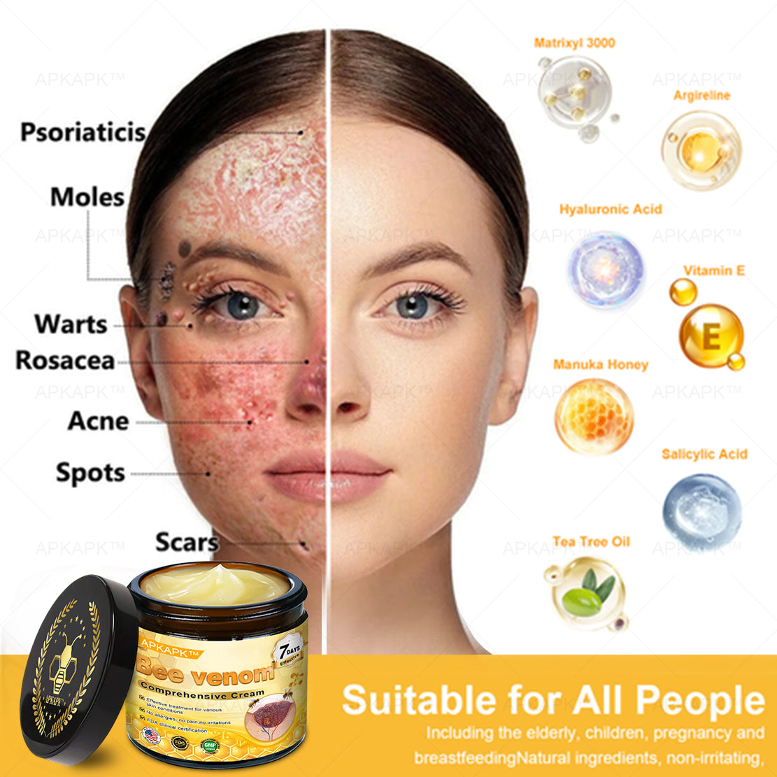 Mayo Clinic Official:🥇🥇 APKAPK™ Bee Venom Skin Treatment Cream, Anti-aging, Hydrating, Skin Repair, Even Tone, Acne and Dark Spot Treatment, Wart and Mole Removal, Psoriasis Relief