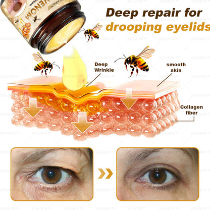 Mayo Clinic Official: APKAPK™ Bee Venom Skin Treatment Cream, Anti-aging, Hydrating, Skin Repair, Even Tone, Acne and Dark Spot Treatment, Wart and Mole Removal, Psoriasis Relief🥇