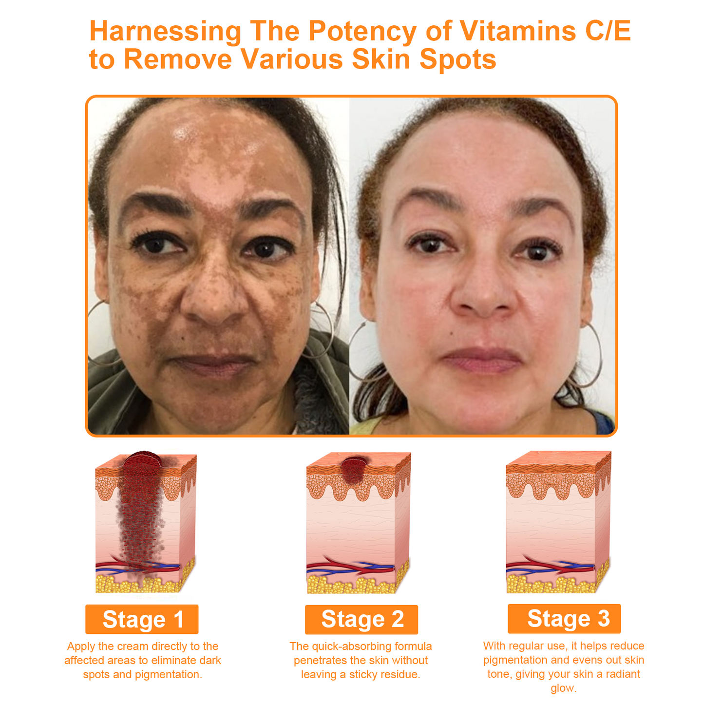 Mayo Clinic Official:🥇🥇 APKAPK™ Bee Venom Skin Treatment Cream, Anti-aging, Hydrating, Skin Repair, Even Tone, Acne and Dark Spot Treatment, Wart and Mole Removal, Psoriasis Relief