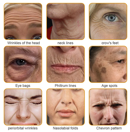 Mayo Clinic Official:🥇🥇 APKAPK™ Bee Venom Skin Treatment Cream, Anti-aging, Hydrating, Skin Repair, Even Tone, Acne and Dark Spot Treatment, Wart and Mole Removal, Psoriasis Relief