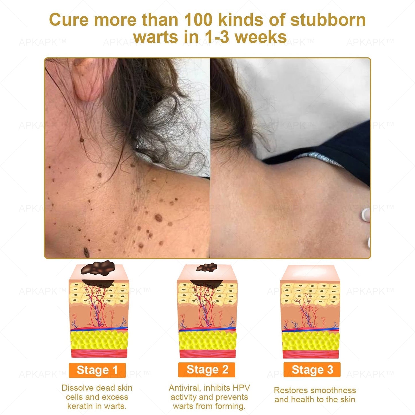 Mayo Clinic Official:🥇🥇 APKAPK™ Bee Venom Skin Treatment Cream, Anti-aging, Hydrating, Skin Repair, Even Tone, Acne and Dark Spot Treatment, Wart and Mole Removal, Psoriasis Relief