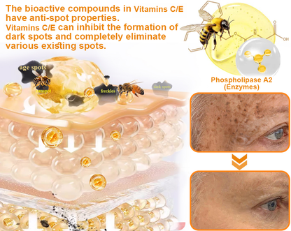 Mayo Clinic Official:🥇🥇 APKAPK™ Bee Venom Skin Treatment Cream, Anti-aging, Hydrating, Skin Repair, Even Tone, Acne and Dark Spot Treatment, Wart and Mole Removal, Psoriasis Relief