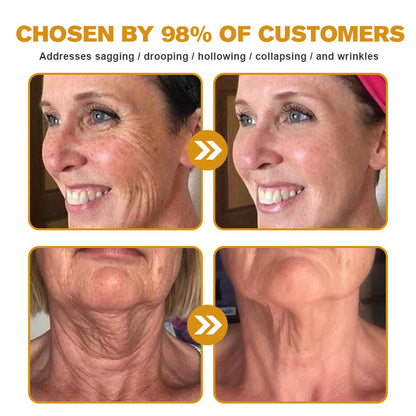 𝐌𝐚𝐲𝐨 𝐂𝐥𝐢𝐧𝐢𝐜 𝐎𝐟𝐟𝐢𝐜𝐢𝐚𝐥:🥇 𝐀𝐏𝐊𝐀𝐏𝐊™ 𝐁𝐞𝐞 𝐕𝐞𝐧𝐨𝐦 𝐒𝐤𝐢𝐧 𝐑𝐞𝐬𝐭𝐨𝐫𝐚𝐭𝐢𝐨𝐧 𝐂𝐫𝐞𝐚𝐦, 𝐀𝐧𝐭𝐢-𝐚𝐠𝐢𝐧𝐠, 𝐇𝐲𝐝𝐫𝐚𝐭𝐢𝐧𝐠, 𝐒𝐤𝐢𝐧 𝐑𝐞𝐩𝐚𝐢𝐫, 𝐄𝐯𝐞𝐧 𝐓𝐨𝐧𝐞, 𝐀𝐜𝐧𝐞 𝐚𝐧𝐝 𝐃𝐚𝐫𝐤 𝐒𝐩𝐨𝐭 𝐓𝐫𝐞𝐚𝐭𝐦𝐞𝐧𝐭, 𝐖𝐚𝐫𝐭 𝐚𝐧𝐝 𝐌𝐨𝐥𝐞 𝐑𝐞𝐦𝐨𝐯𝐚𝐥, 𝐏𝐬𝐨𝐫𝐢𝐚𝐬𝐢𝐬 𝐑𝐞𝐥𝐢𝐞𝐟