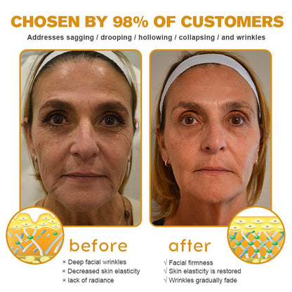 🎁🎁Only 6 jars left! We are offering you an additional 50%discount! Get yourself theperfect skin. If you miss it now, you won't get it until next year.